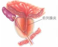 ǰ���ٵĲ���