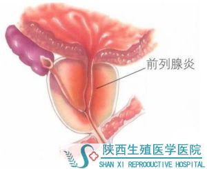 ����ǰ�����׵ęz���Ŀ