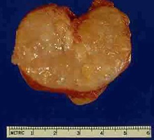 ǰ����������ʲô