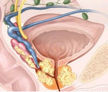 ǰ����ʹ�İY��