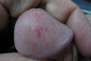 ���^��Ƥ�׵İY����F(xi��n)����Щ