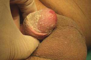 ��Ƥ�׵��ί���������Щ