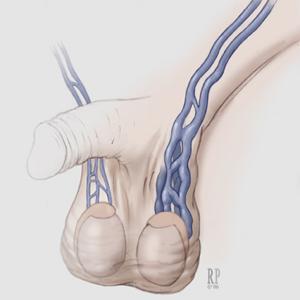 �����o�}�����İl(f��)��ԭ����ʲô��