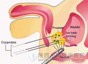 ���^�мt�߰�Ƥ�t�[����ô���£�