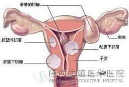 Ů�^��ʮ��С�Ļ��ӌm��