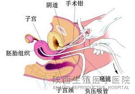 ���������o(w��)ʹ���������X(qi��n)��